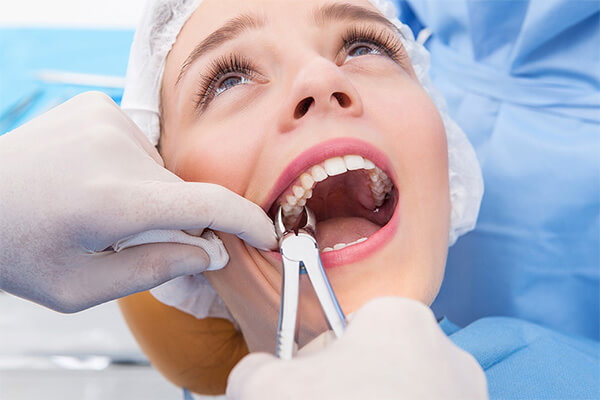 teeth Extraction whitening