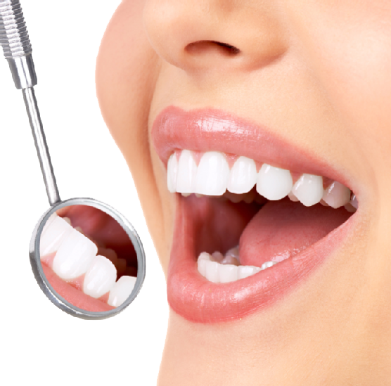 dentist bleaching whitening